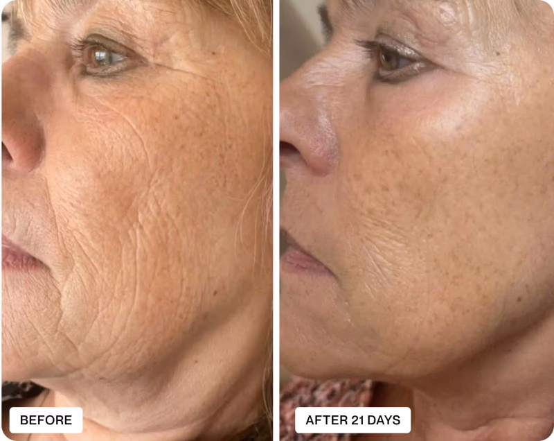 before and after comparison of skin treatment results