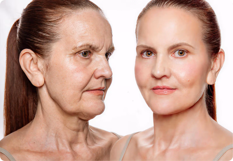 before and after skin rejuvenation comparison