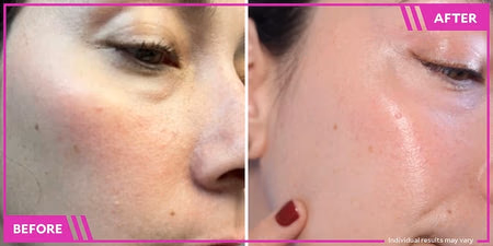before and after skincare product application on cheek