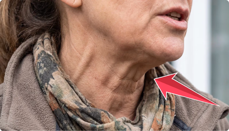 close up of a womans neck with a red arrow pointing to wrink