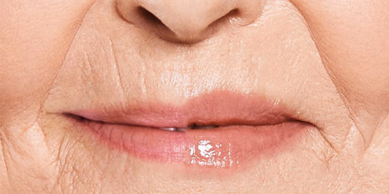 close up of lips with fine lines