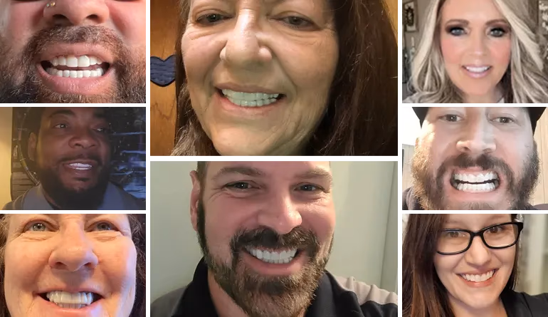 collage of people showing off shiny smile veneers