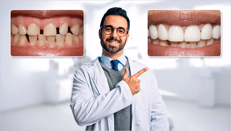 dentist shows before and after of veneers