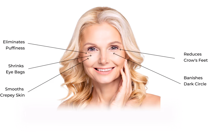 diagram showing renewa eyelift benefits