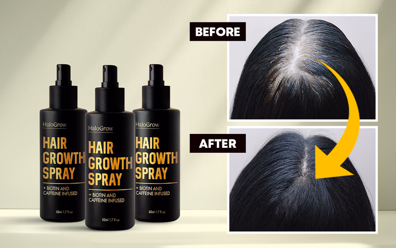 halogrow hair growth spray bottles with before and after hai