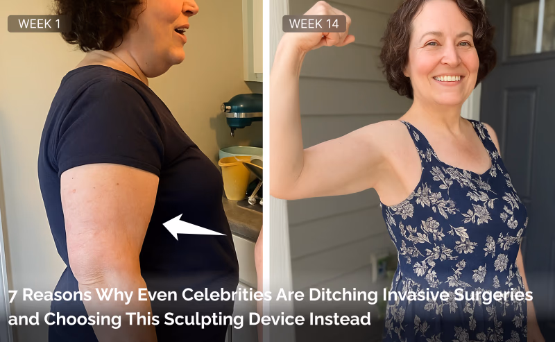 Myoglow Flabby Arms
