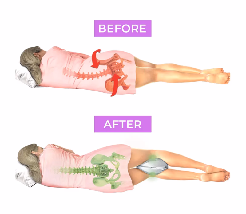 knenest knee pillow before and after alignment