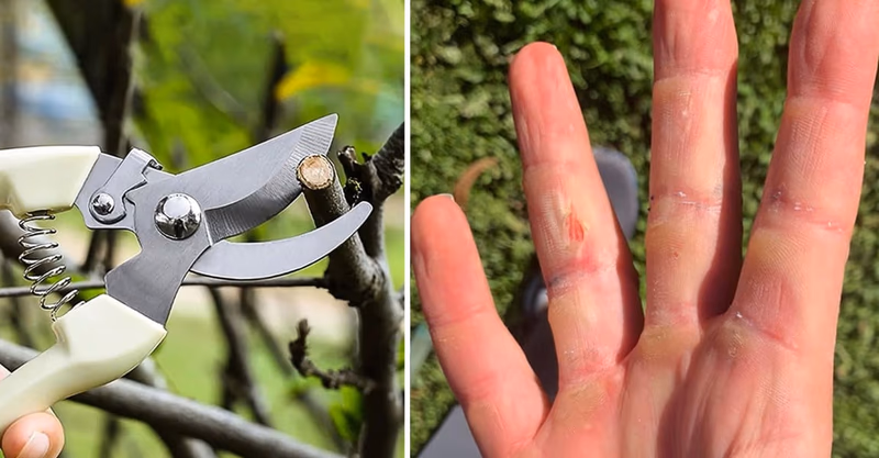 pruning shears cutting a small branch and a hand with bliste