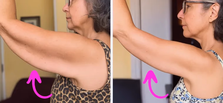 woman shows arm toning before and after results