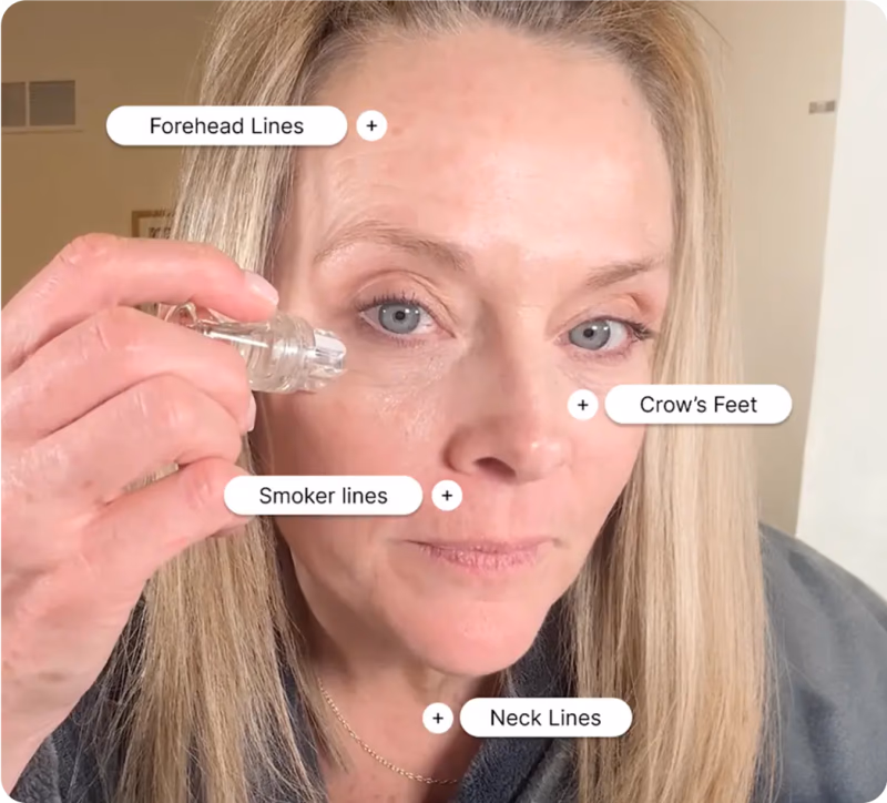 woman using renewa skin micro on forehead lines